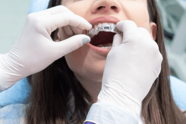 Invisalign